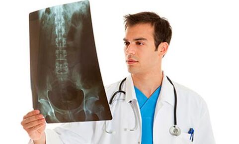 lékař se podívá na rentgen, aby diagnostikoval bolesti dolní části zad